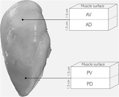 Exploring the Factors Contributing to the High Ultimate pH of Broiler Pectoralis Major Muscles Affected by Wooden Breast Condition